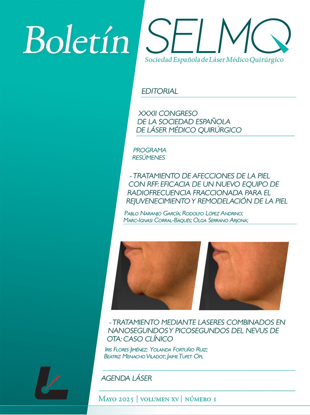 Boletín SELMQ Nº 1